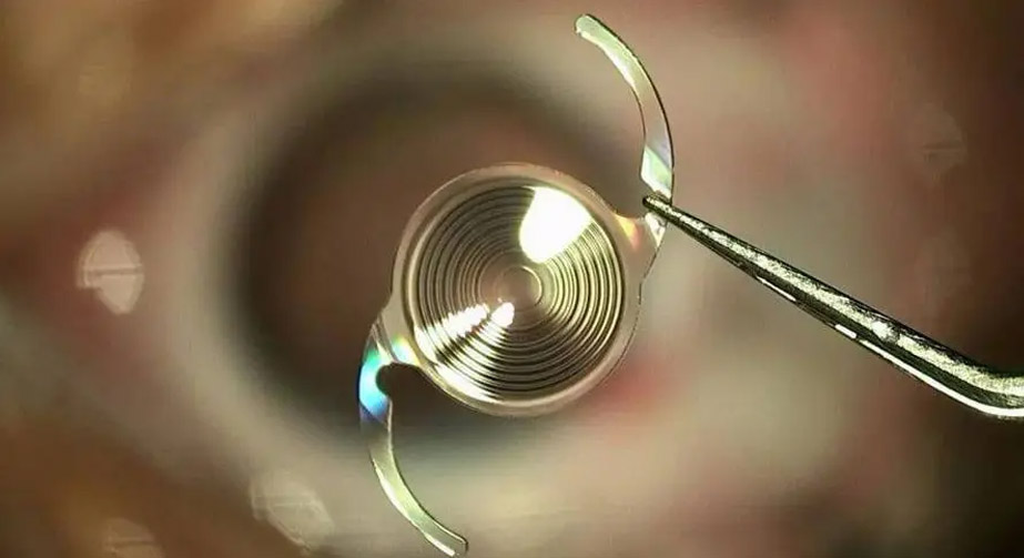 9I在线看片成人免费處理在人工晶狀體肝素塗層過程中的應用