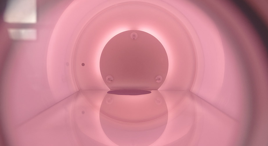 金剛石9I在线看片成人免费體刻蝕